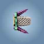 Caja Cervical Bloqueada01