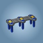 Placa Cervical Anterior01
